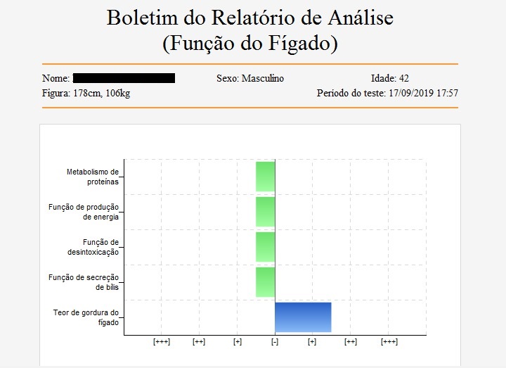 Bianca Enricone - Exame de Biorressonância - Foto Divulgação Bianca Enricone - Exame de Biorressonância - Foto Divulgação