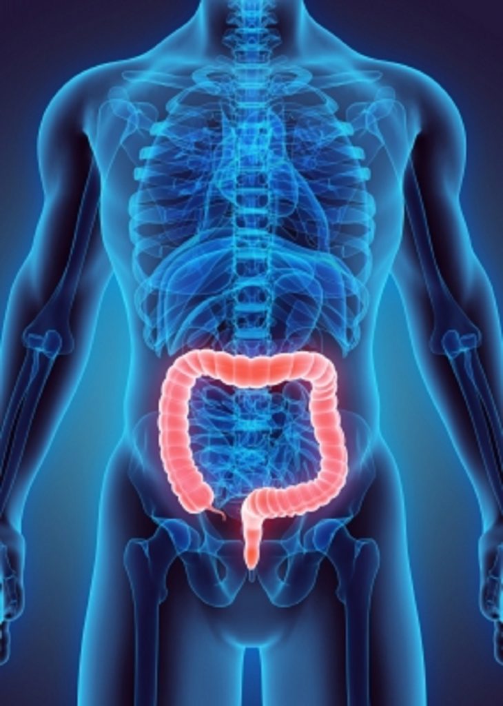 Bianca Enricone -Diverticulite e Diverticulose, Diferenças, Causas e Sintomas- Detox Kriyá - Foto Divulgação